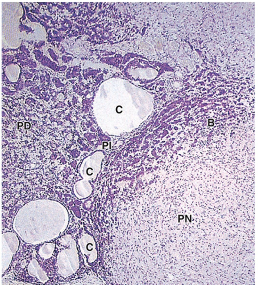 <p>Where is the pars intermedia located?</p>