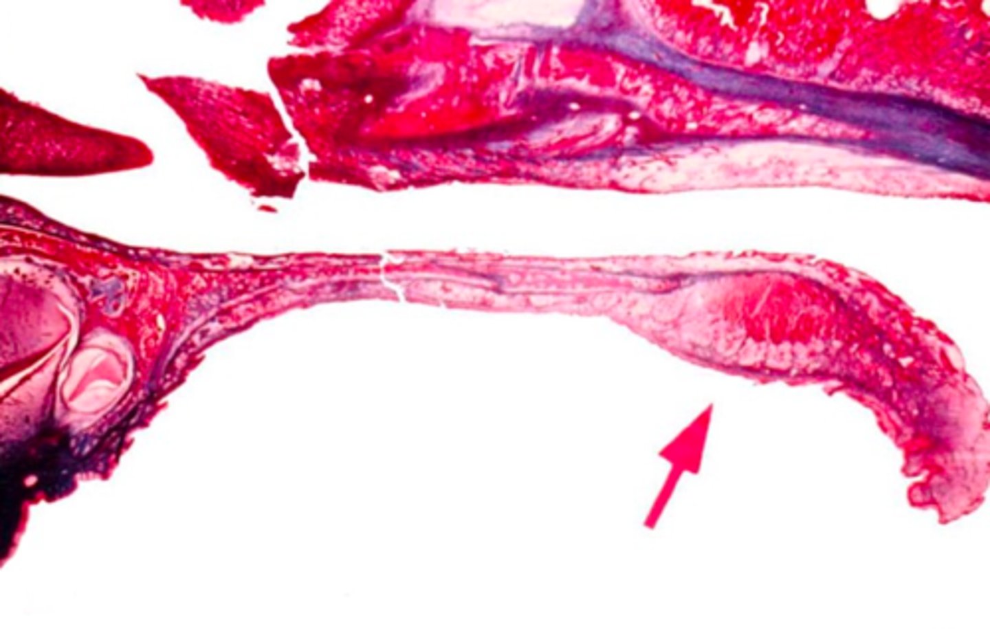 <p><em>identify the mucosa:</em></p>