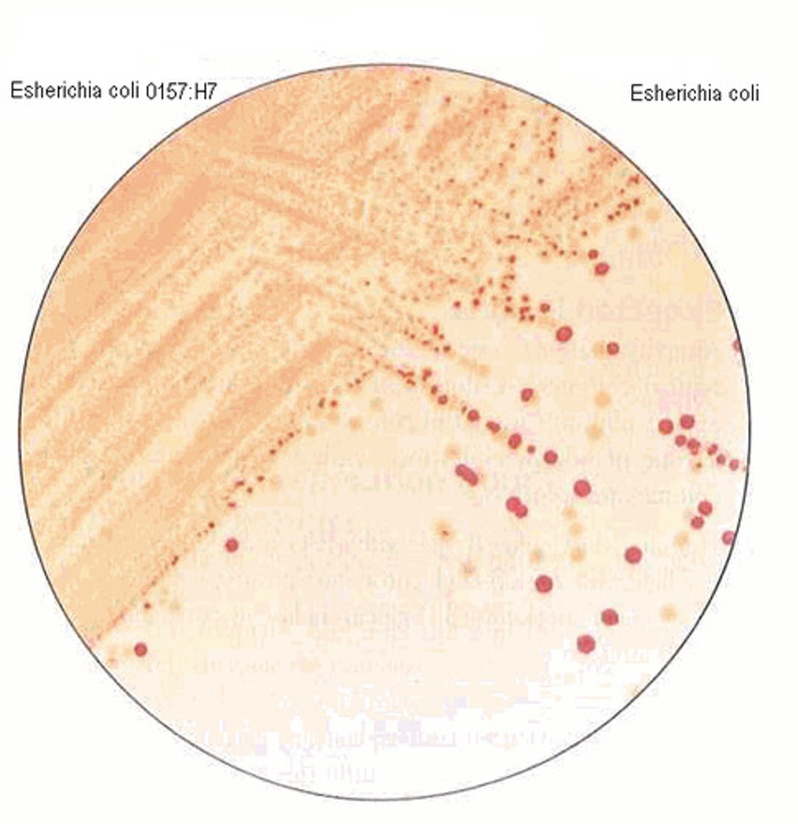 <p>Sorbitol-negative E. coli are serotyped to detect the somatic 157 and flagellar 56 antigens</p>