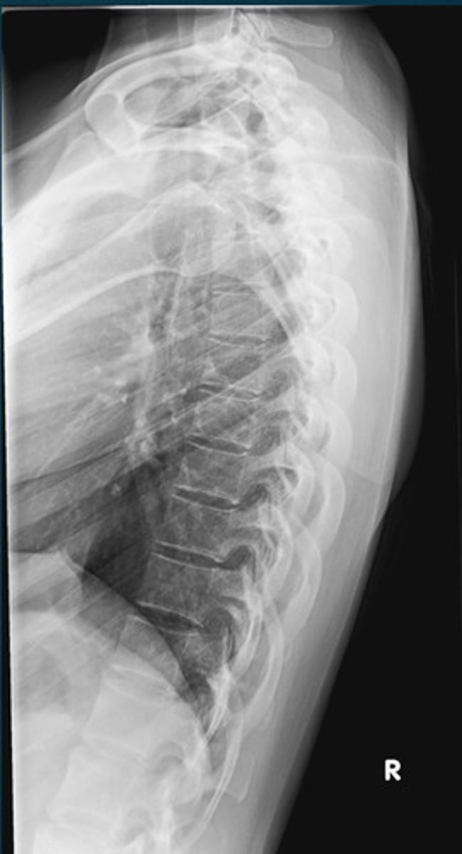 <p>What projection view is this?</p>