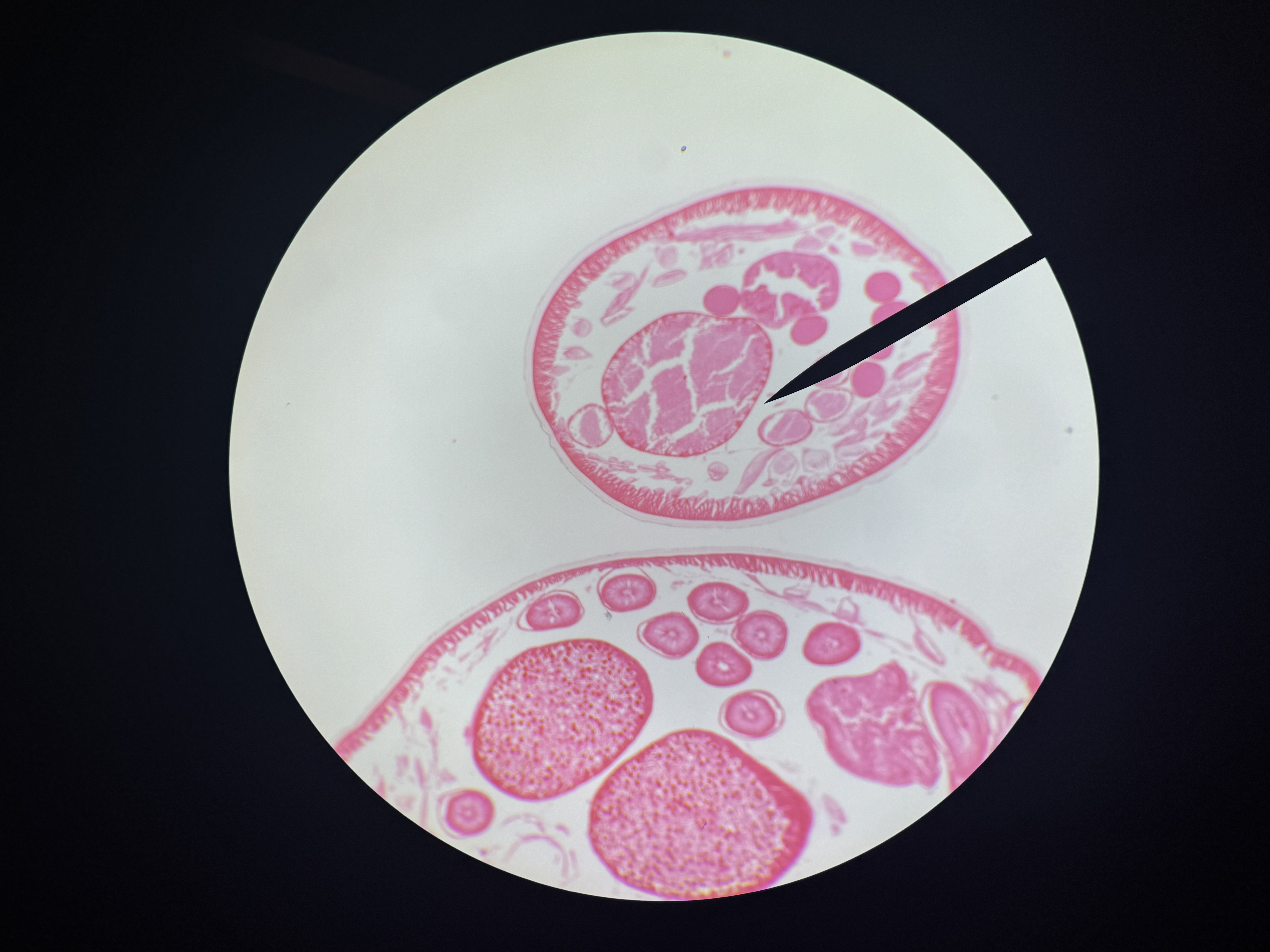 <p>A type of roundworm.</p>