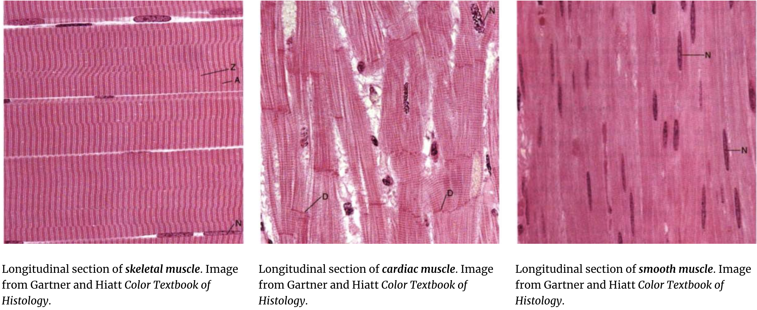 <p>tissue composed of cells that can contract and are responsible for movement of the body and its organs. </p>