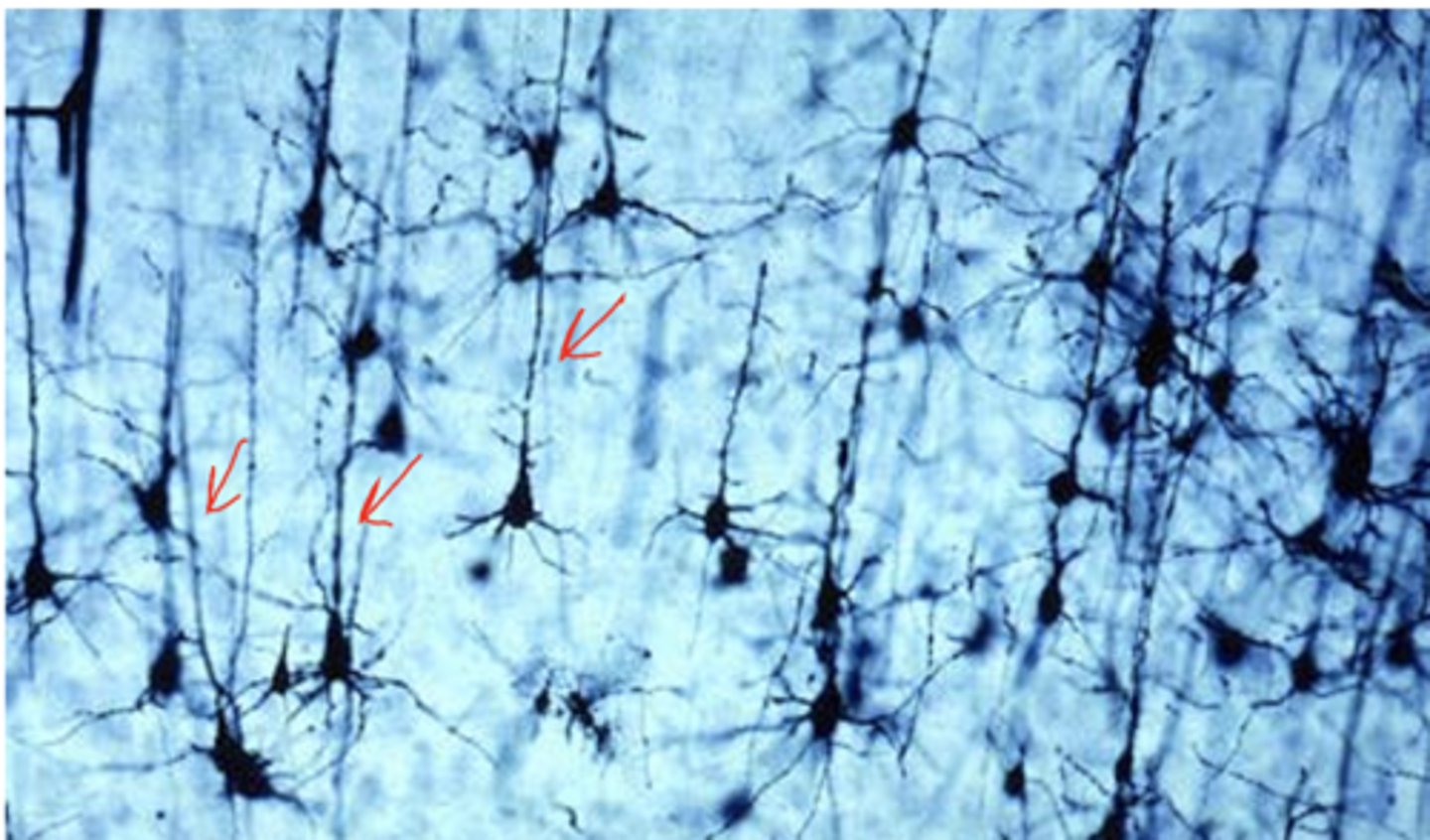 <p>Identify the cells</p>