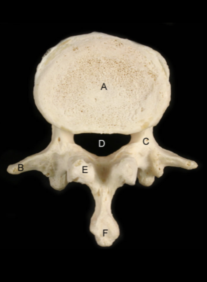 <p>Identify the Structures of the Lumbar Vertebrae - L3 Inferior View</p>