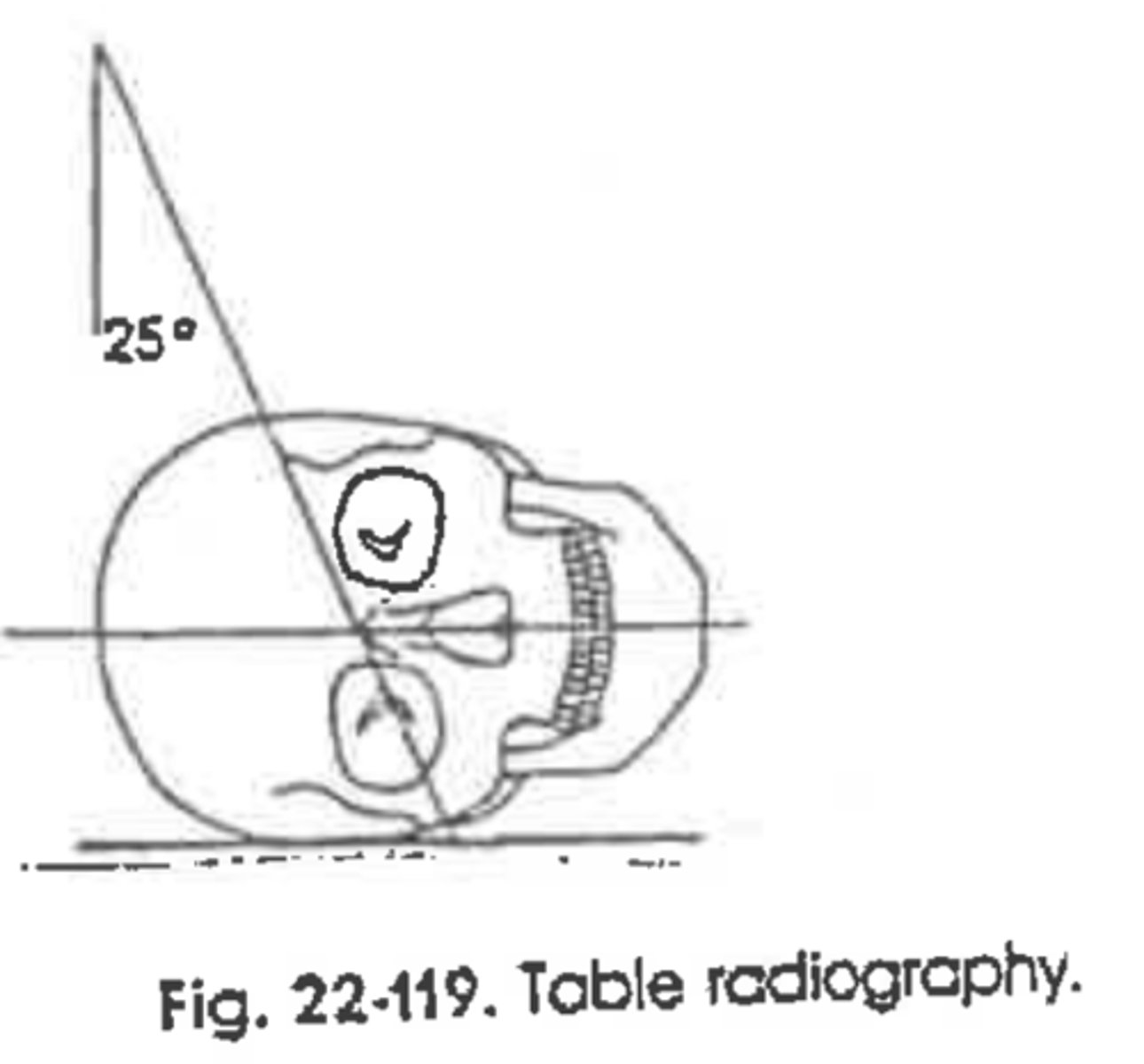 <p>Method:</p><p>Projection:</p><p>Side Vizualized:</p>