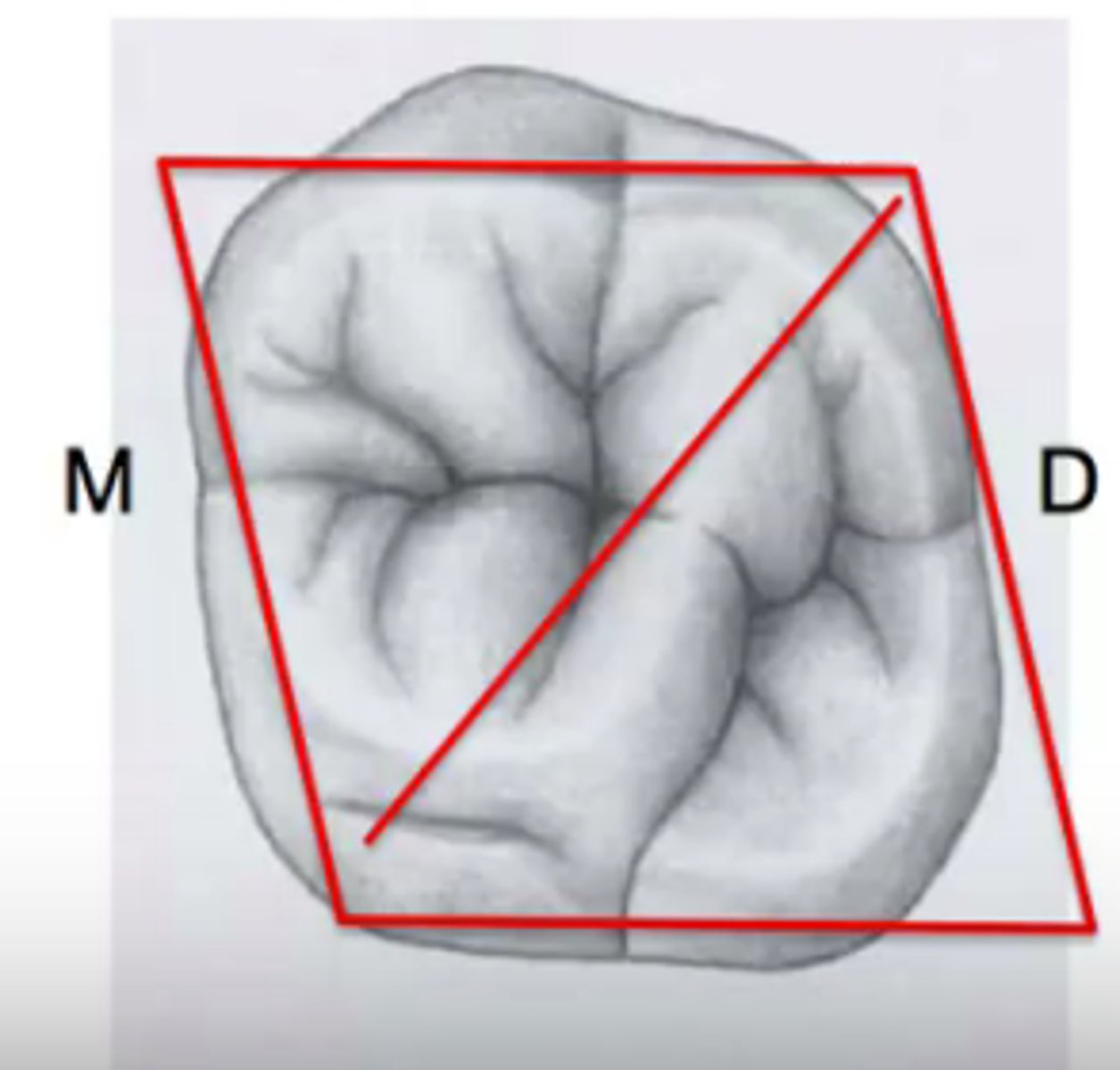 <p>preserve this on 1st max molars!</p>