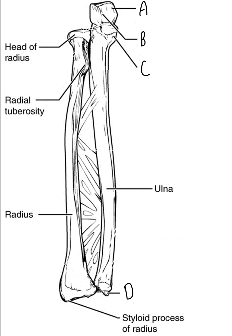 <p>Label the bone markings on the ulna</p>