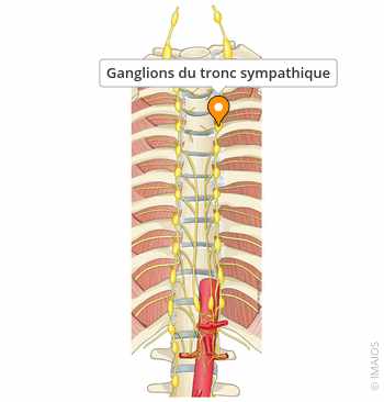 <p>Un amas de corps cellulaires situé à l’extérieur du SNC</p>
