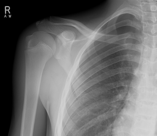 <p>Describe the abnormality demonstrated. </p>