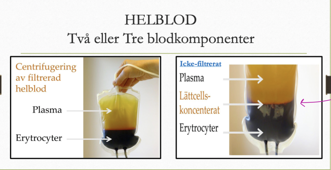 <p>Ej filtrerat: 3 blodkomponenter (erytrocyter, trombocyter och plama).</p><p>Filtrerat: 2 blodkomponenter (erytrocyter och plasma). </p>