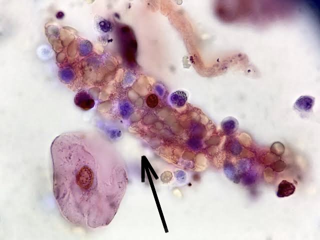 <ol><li><p>Identify pointed structure.</p></li><li><p>What pathologic conditions is this structure associated with?</p></li></ol><p></p>