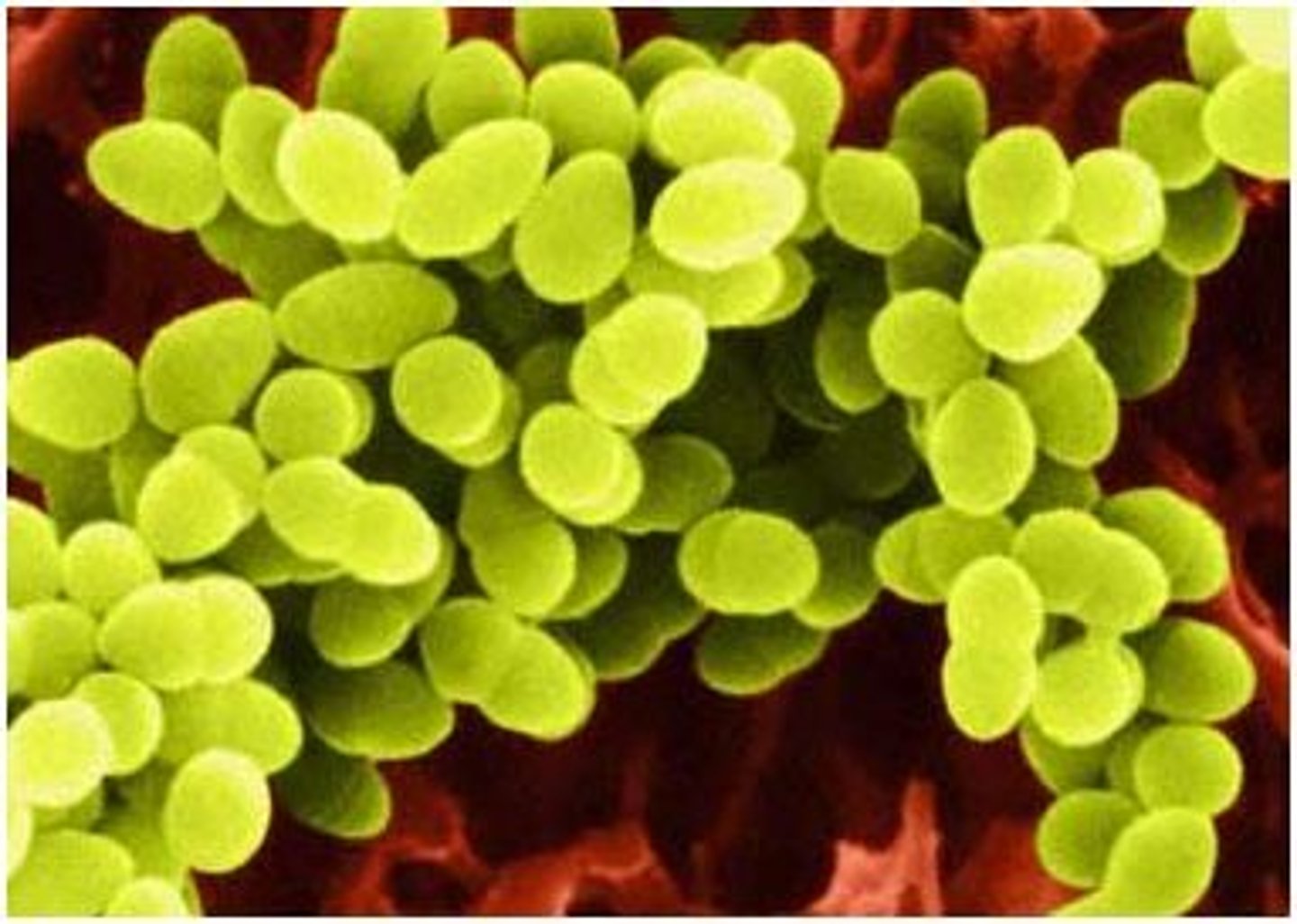 <p>Spherical bacteria</p><p>- Ex: Streptococcus pyogenes</p>