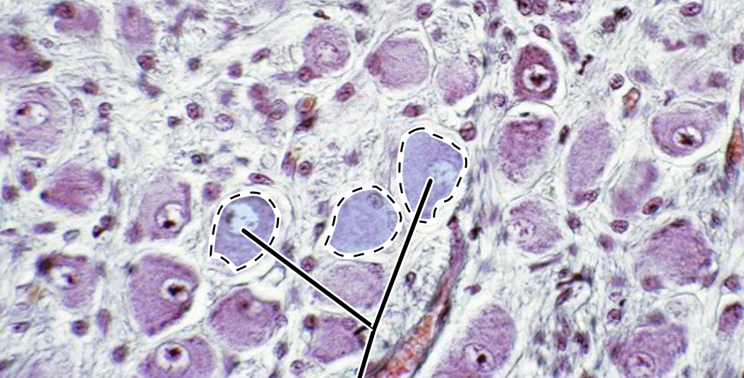 <p>located in the dorsal ganglia of the spinal cord</p>