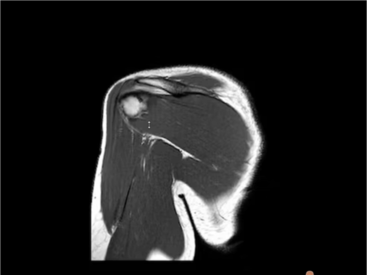 <p>What type of view is this? Anterior vs. posterior? How do you know?</p>
