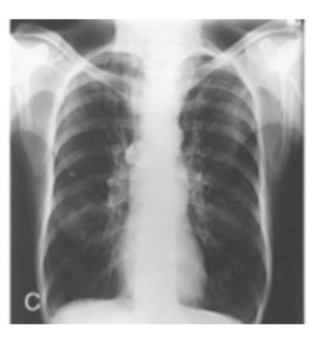 <p>Identify which body habitus this is</p>