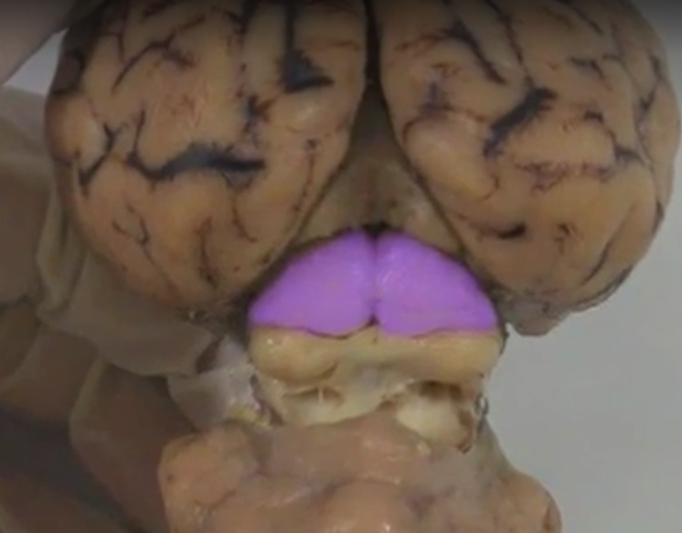 What part of the brain is this called?