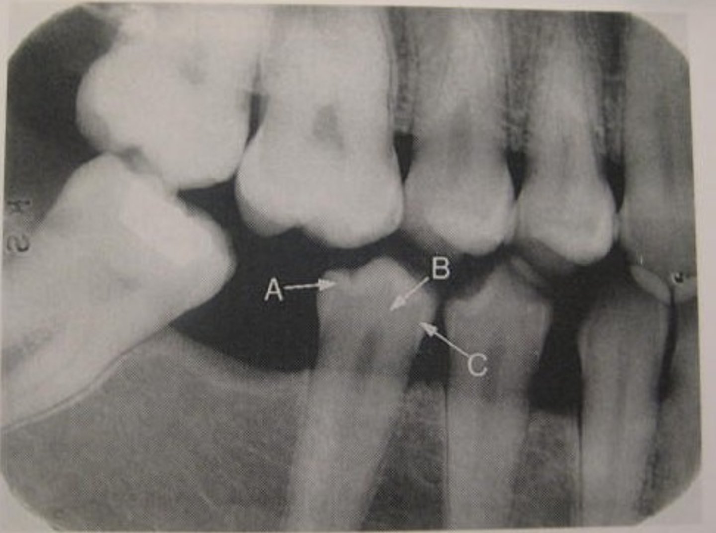 <p>What arrow C pointing to?</p>