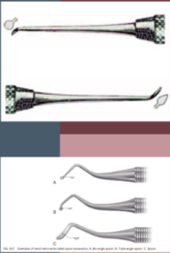 <p>spoon excavator </p>