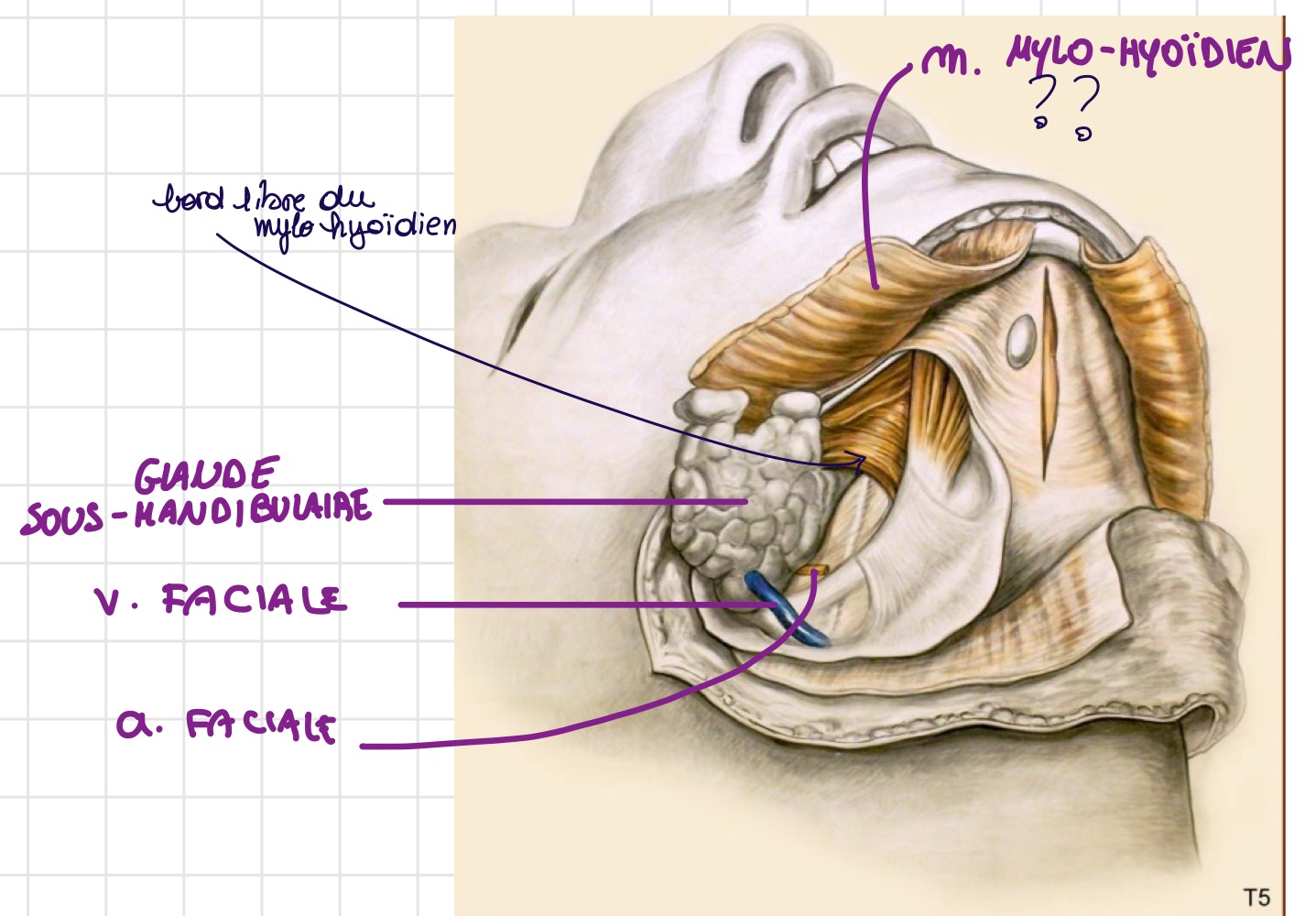 <p>• Veine faciale<br />
• Artère faciale<br />
• Canal de Wharton<br />
• Glande sous-linguale</p>