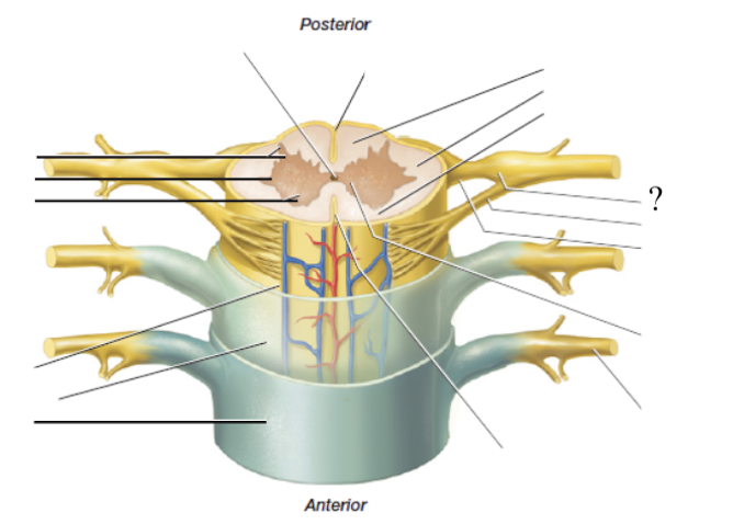 <p>contains the neurosoma/cell bodies of the sensory nerves traveling to the spinal cord </p><ul><li><p>has a bulbous/swollen appearance</p></li></ul><p></p>