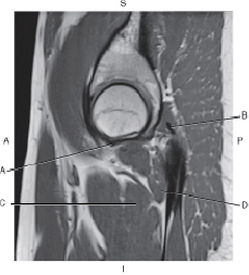 <p>Which line is pointing to the pectineus muscle?/</p>