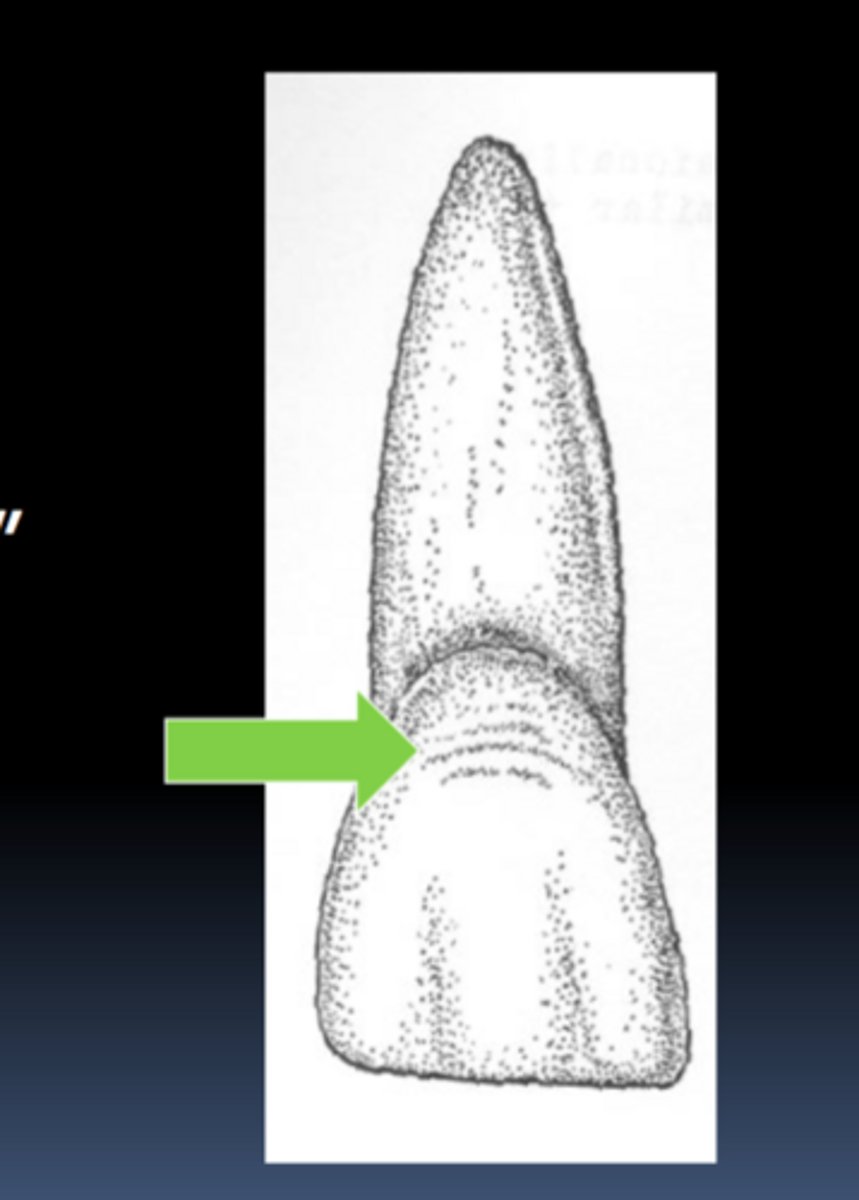 <p>surface manifestations of striae of retzius, horizontal, seen on labial surface</p>