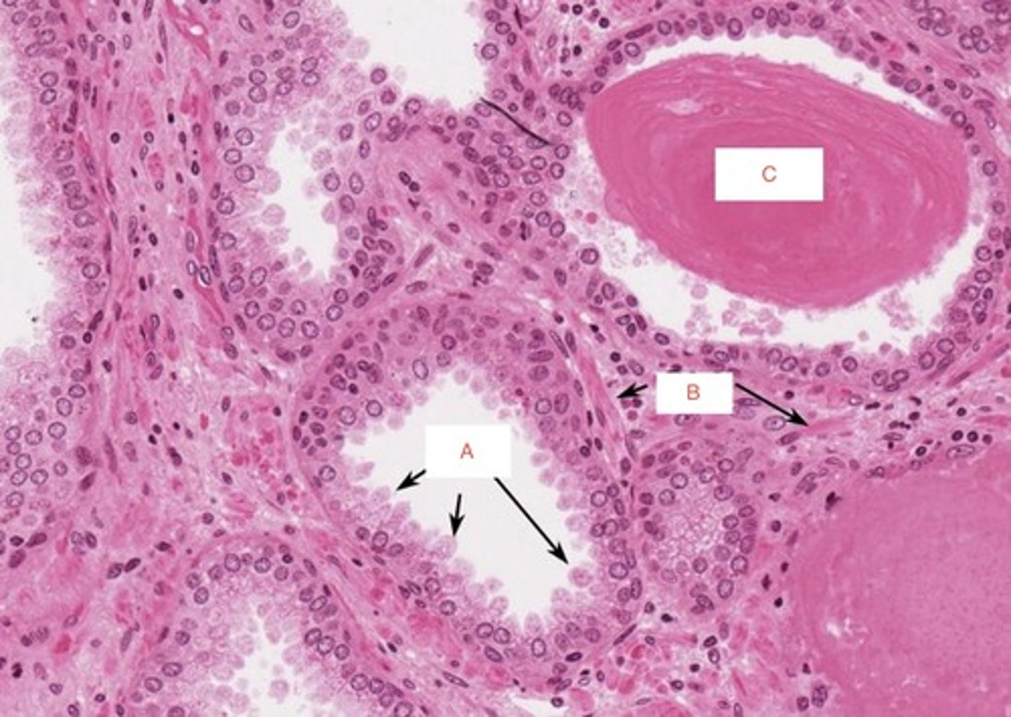 <p>A</p>