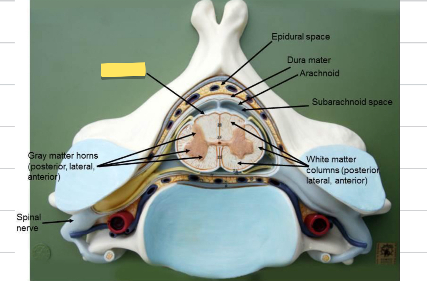 <p>Name this spinal cord part</p>
