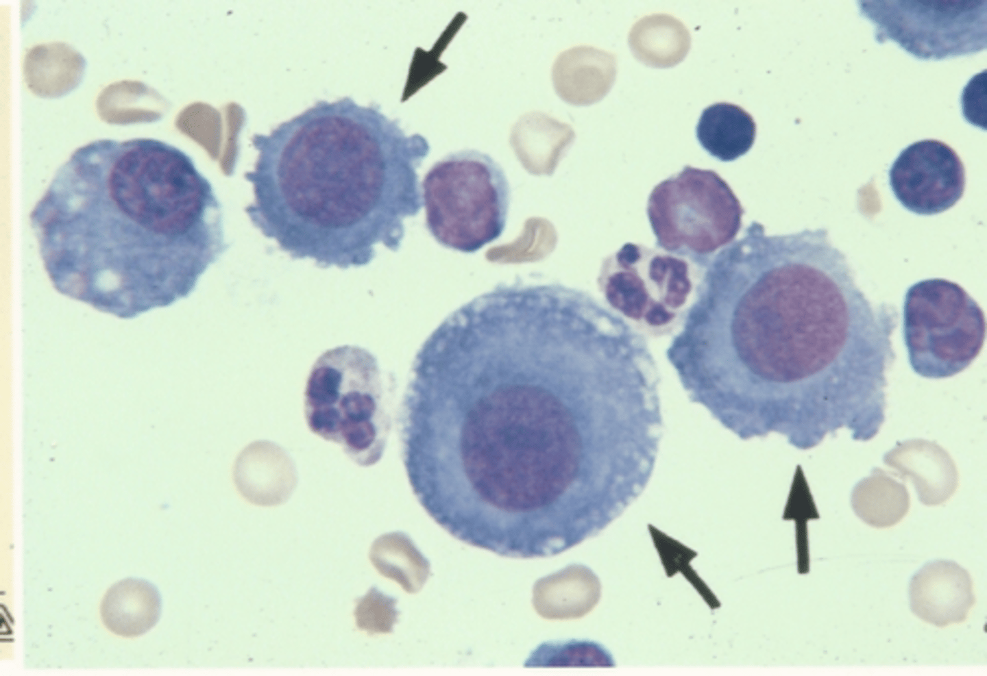 <p>Identify the cells in this body fluid</p>