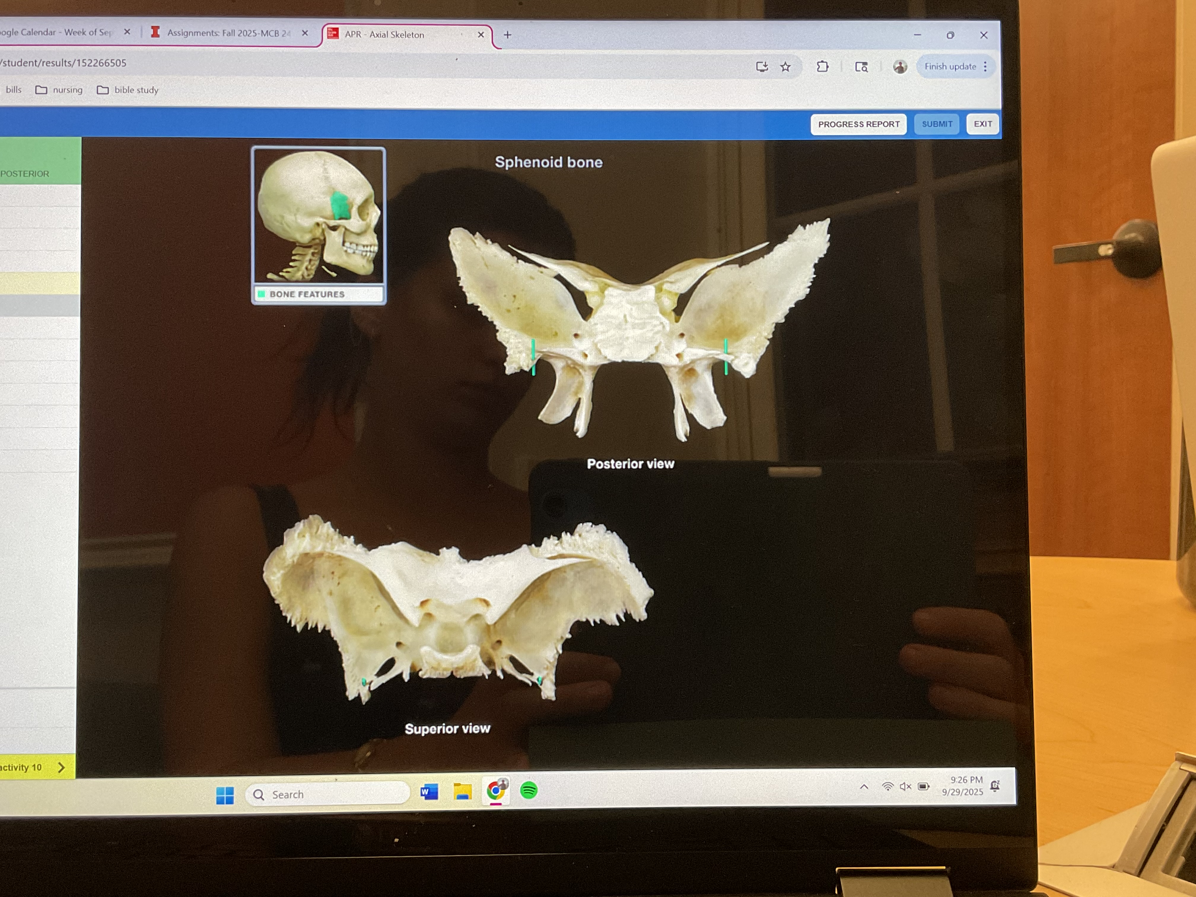 <p>Foramen spinosum </p>