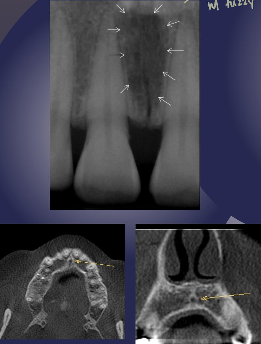 term image