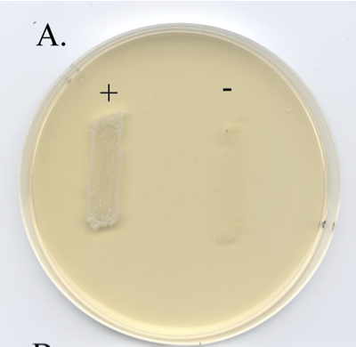 <p><span><span>PEA Agar with growth of Gram +ve organism (left) and Gram –ve organism (right) with inhibited growth.</span></span></p>