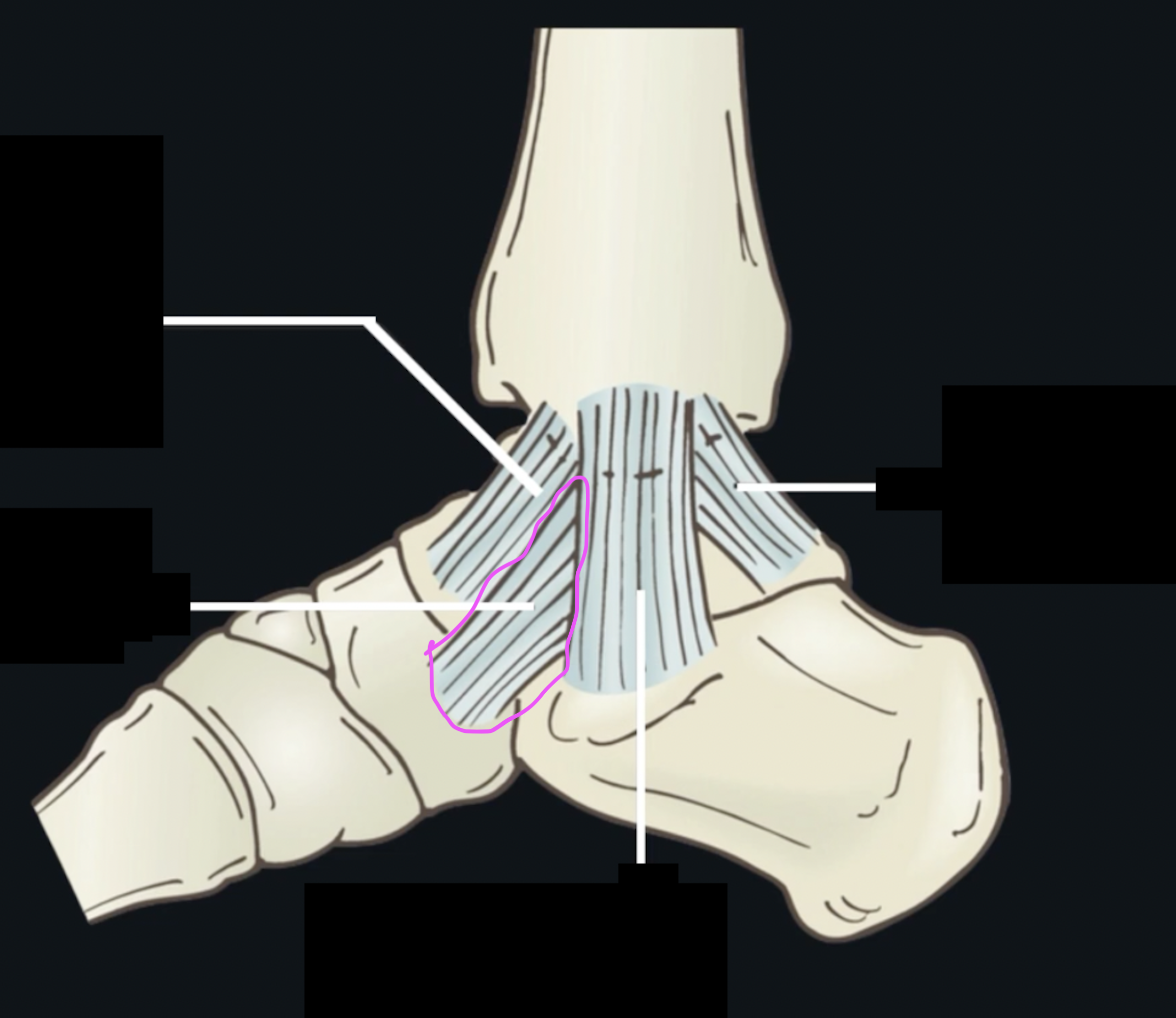 <p>What ligament is this? </p>
