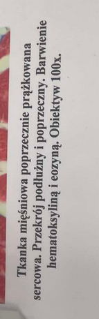 <p>posiada rozgałęzienia i wstaki co pozawala na przekazywanie impulu</p>