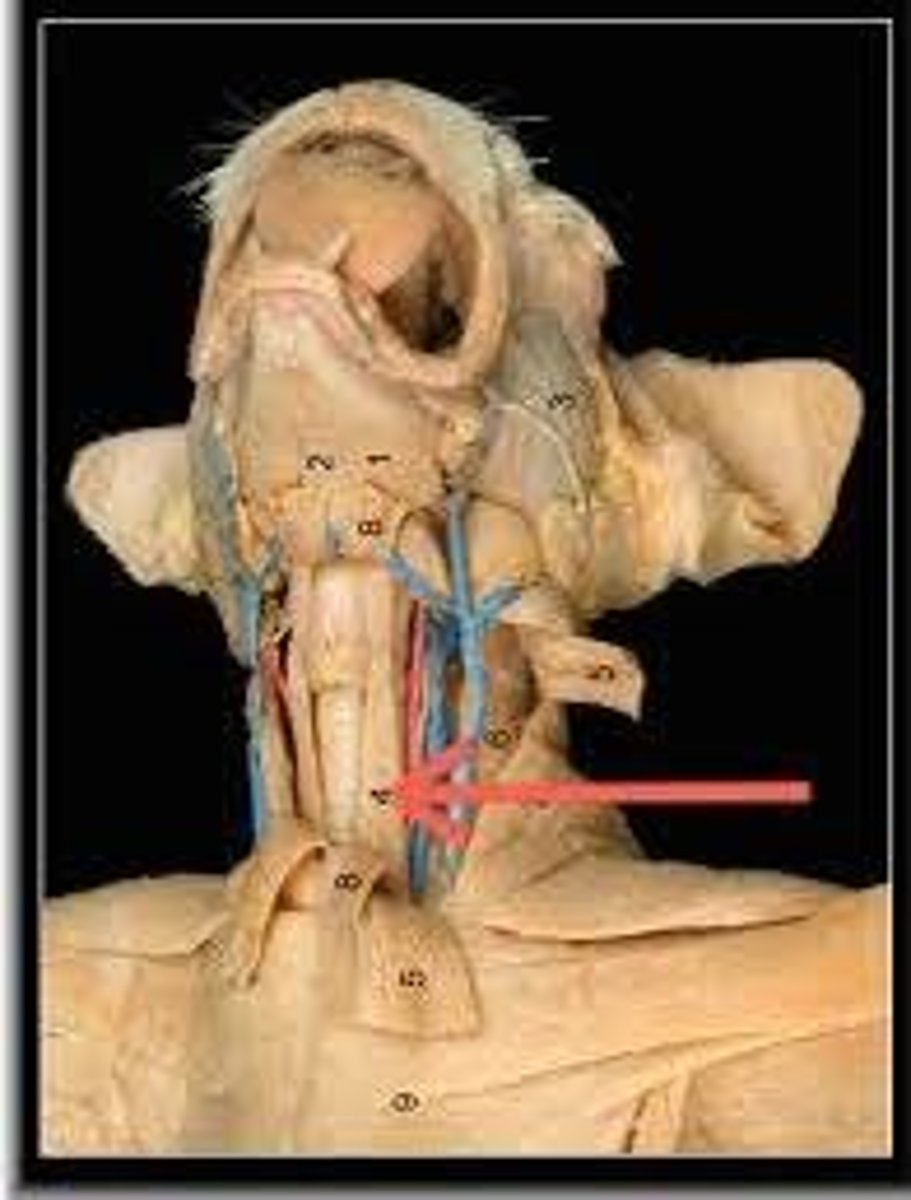 <p>What muscle is this?</p><p>Origin?</p><p>Insertion?</p><p>Function?</p><p>Innervation?</p>
