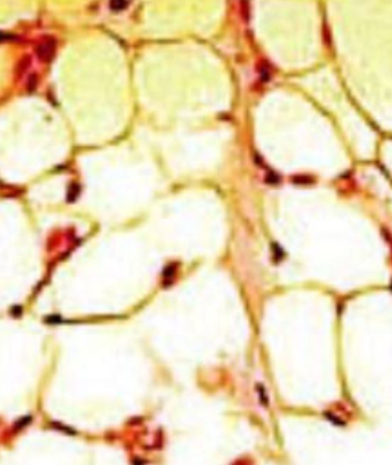 <p>Major function: lipid storage</p><ul><li><p>Adipocytes are the predominant cell type (90%)</p><ul><li><p>can develop anywhere there is areolar tissue</p></li></ul></li><li><p>matrix is rare</p></li><li><p>cells are packed close together</p></li><li><p>richly vascularized</p></li></ul><p></p>