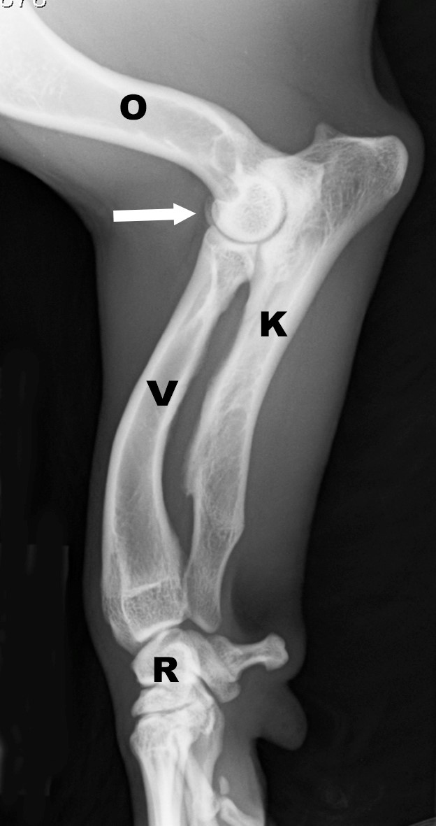 <p>Short radius/ulna causing bending in the opposite bone</p><ol><li><p>A metabolic disorder affecting bone growth</p></li><li><p>Viral disorders</p></li></ol><p></p>