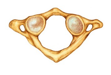 <p>1st vertebra-no body</p>