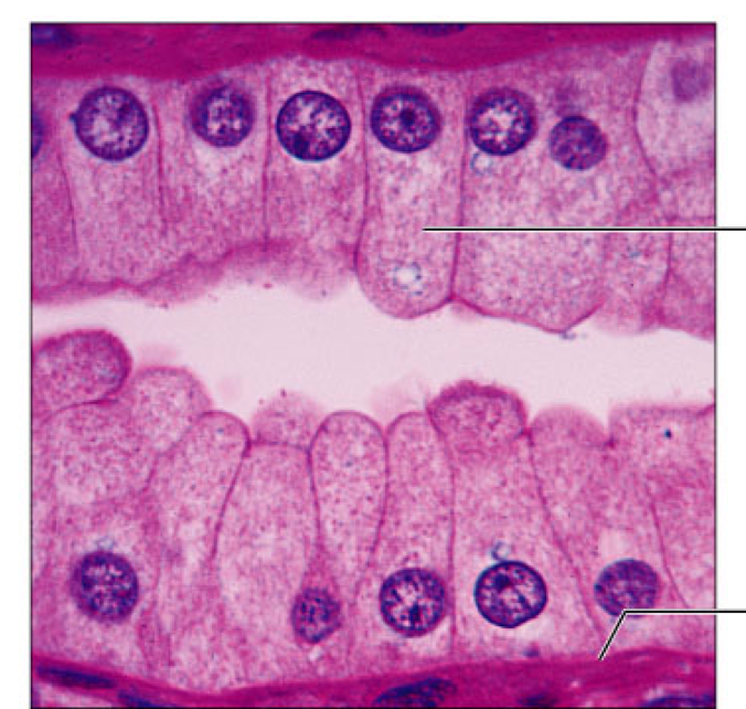 <p>simple columnar</p>