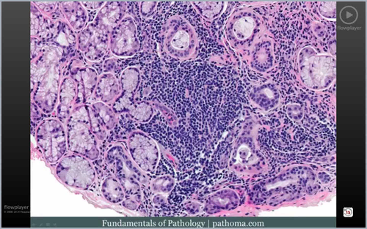 <p>salivary gland shows</p>
