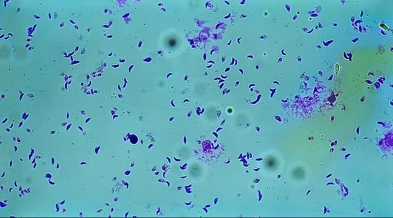 <p><span data-name="microscope" data-type="emoji">🔬</span><span data-name="petri_dish" data-type="emoji">🧫</span><strong><span> </span>Na podstawie zdjęcia preparatu:</strong></p><p></p><ul><li><p><span>📖 </span>rozpoznaj gatunek pasożyta;</p></li></ul><p></p><ul><li><p><span>♻ </span>rozpoznaj wszystkie formy rozwojowe;</p></li></ul><p></p><ul><li><p><span>🦠 </span>wskaż organelle i cechy charakterystyczne dla danego gatunku;</p></li></ul><p></p><ul><li><p><span>😷 </span>nazwij chorobę, którą pasożyt wywołuje.</p></li></ul><p></p>