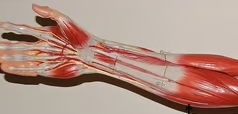 <p>What muscle is this?*****</p>