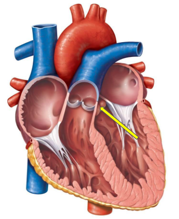 term image