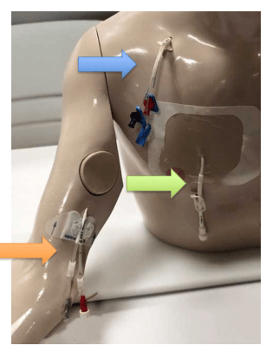 <p>What does blue arrow show?</p>