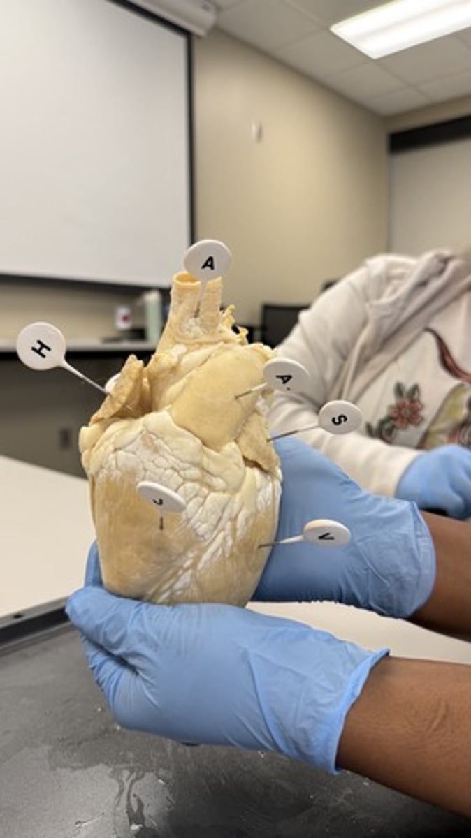 <p>right ventricle</p>