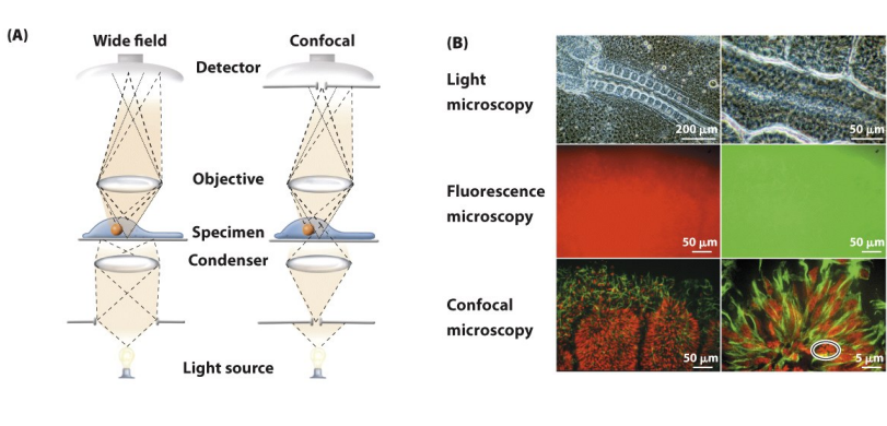 <ul><li><p>ilumination achieved by scanning one or + beams of light from laser across specimin</p></li><li><p>Collect Z series to create high resolution 3D images of sample</p></li></ul><p></p>