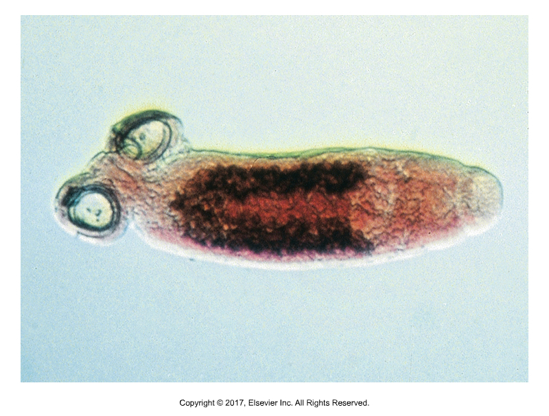 <ul><li><p>Attach to gills, skin, fins or mouth​</p></li><li><p>Posterior adhesive organ: suckers, hooks or clamps​</p></li><li><p>Usually only diagnosed in specialty practices that do saltwater or freshwater fish or fish farming</p></li></ul><p></p>