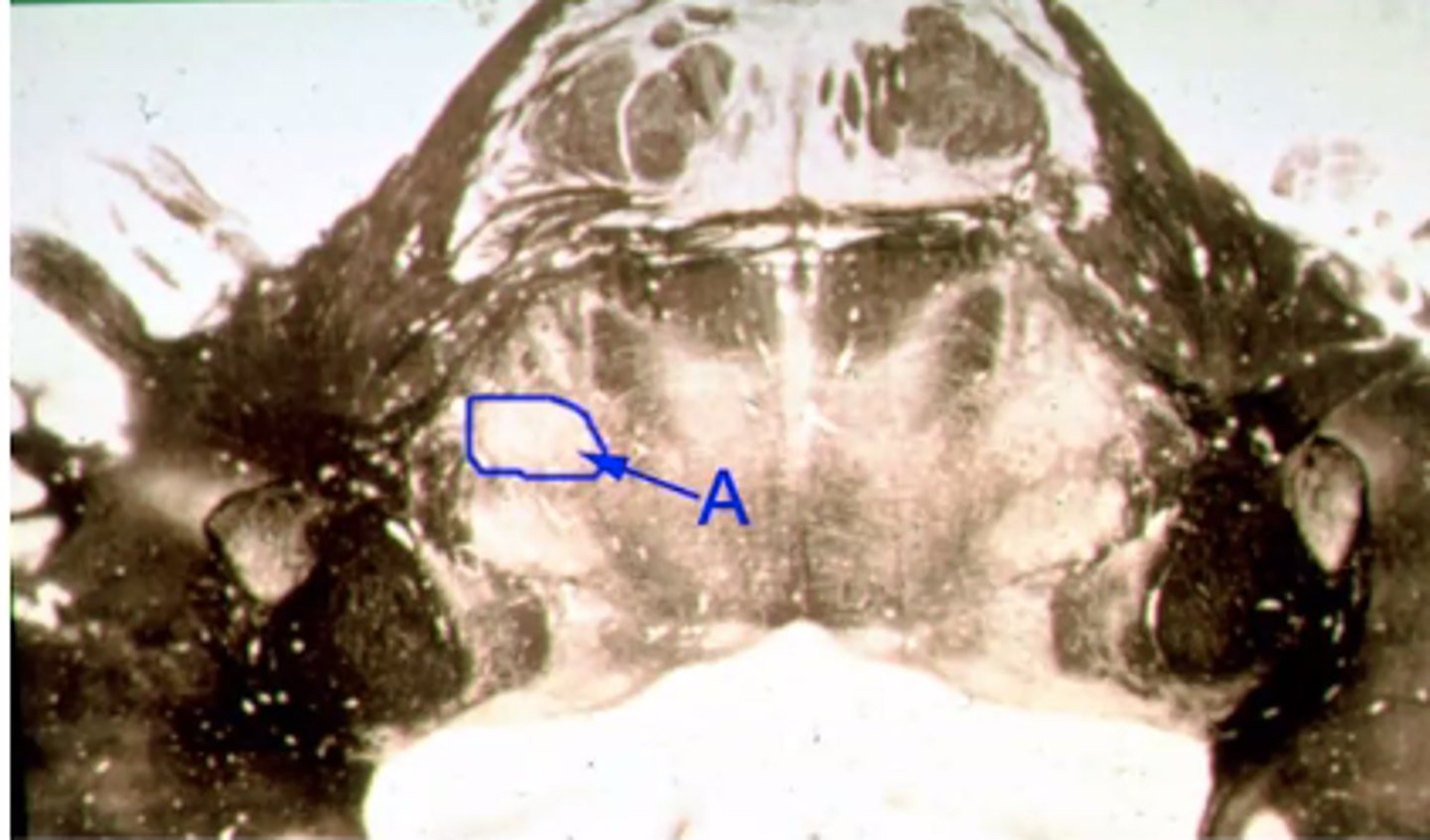 <p>Identify the structures indicated by the outline and letter "A"</p>