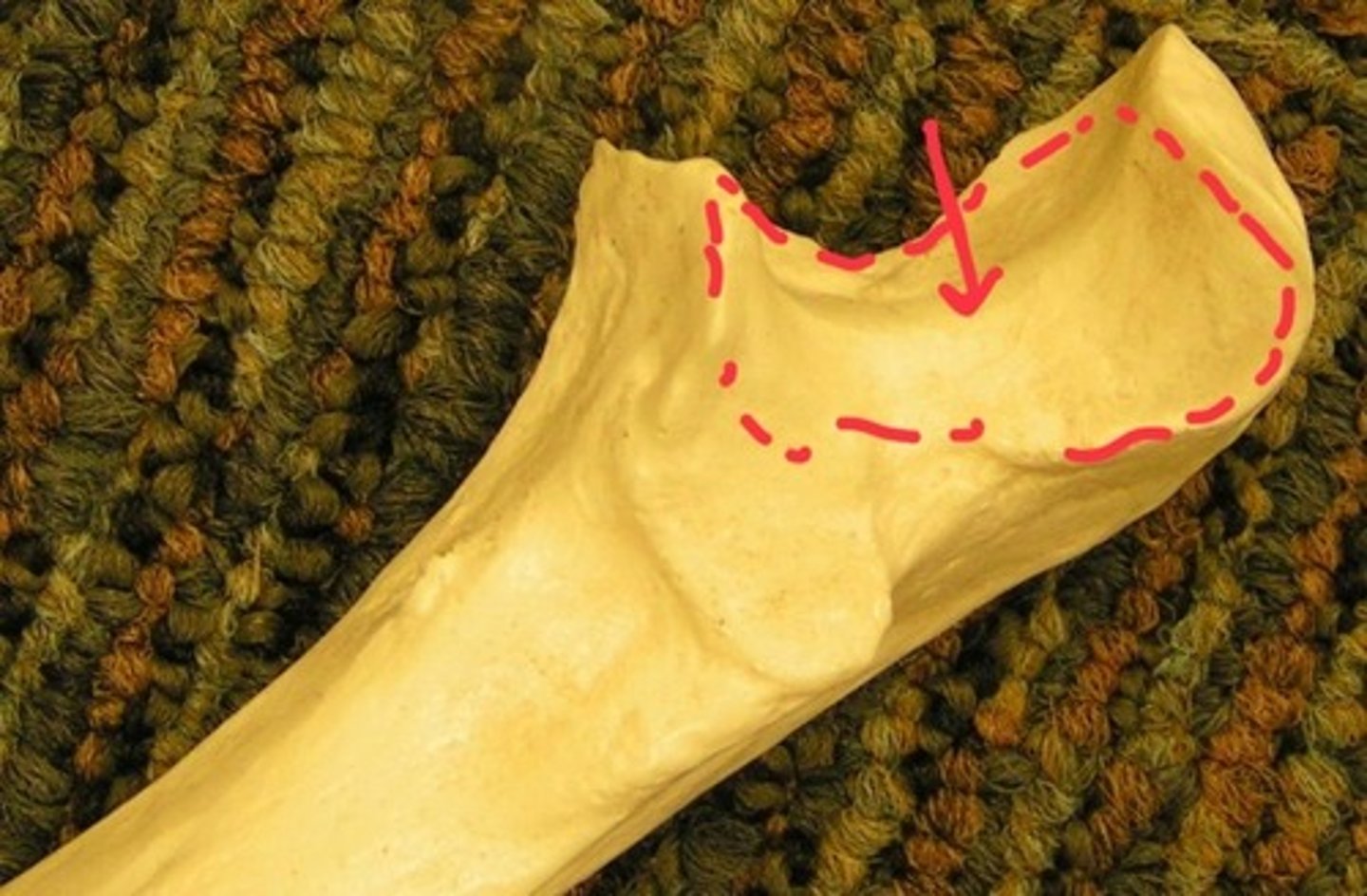 <p>anterior</p>