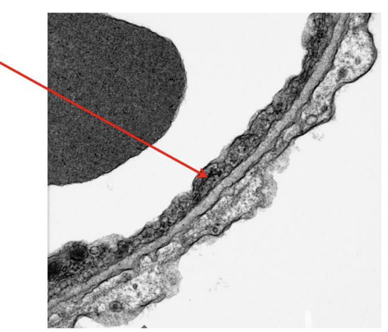 <p><span><span>In the attached EM of the blood-air barrier, the structure indicated by the arrow is most likely which of the following?</span></span></p>